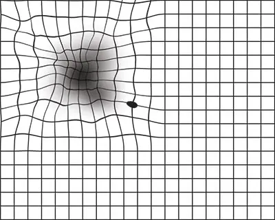 Abnornal Amler Grid